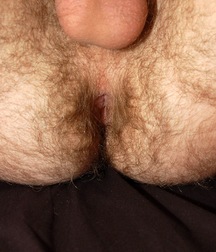 Colby full set 58b6336f0ed0a.jpg