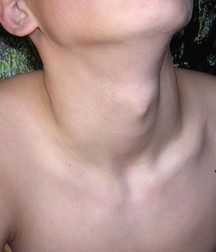 Grinja. 5bddd1a98fd01.jpg