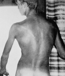 Vintage Solo 4 5b2269e4d0f20.jpg