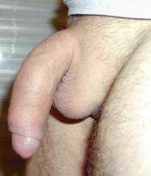 GENITAL GIANTS 5a1232957b29a.jpg