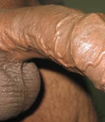 GENITAL GIANTS 5a123299651d0.jpg