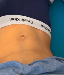 pics of me 58cd30423d529.jpg