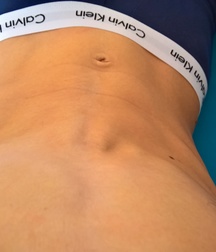 pics of me 58cd305160fa3.jpg