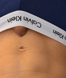 pics of me 58cd307102e86.jpg
