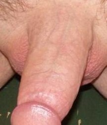 My Cock 570f7d4303eb3.jpg