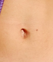 Alfie outdoors 5a6d42977bfb7.jpg