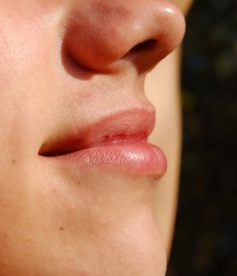 Alfie outdoors 5a6d42a075633.jpg