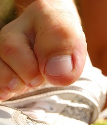 Alfie outdoors 5a6d431d893e7.jpg