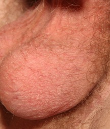 anatol 5a6dfb6126c83.jpg