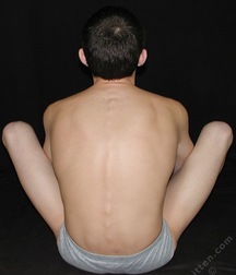 anto 5a72e548d6370.jpg