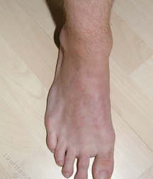 artie 5a7b966c1daef.jpg