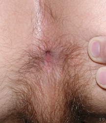 artie 5a7b969699eee.jpg