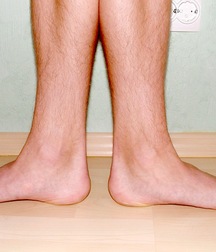 artie 5a7b96cf5d9ca.jpg