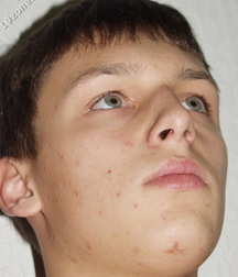 angelo 5ab0507280810.jpg