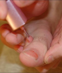 guy foot 5addb4be5d04c.jpg