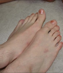 guy foot 5addb5340c61f.jpg