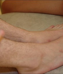 guy foot 5addb535e8dd8.jpg