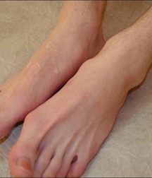 guy foot 5addb542558ee.jpg