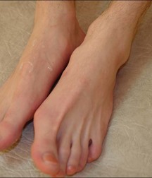 guy foot 5addb5440208d.jpg