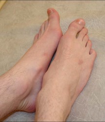 guy foot 5addb544cf9f2.jpg