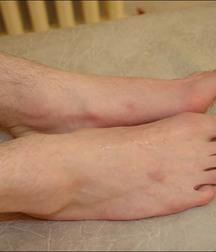 guy foot 5addb545a7c25.jpg