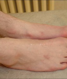 guy foot 5addb54763d48.jpg