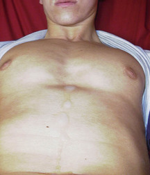 Zack 5b3cf69fc7825.jpg