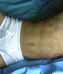 Ivo 5b7a8f9877acd.jpg