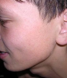 Grinja 5cbd164d4fd6e.jpg