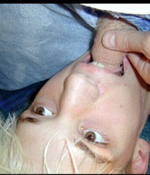 Cocksucker's Eyes 5955ec711a3ff.jpg