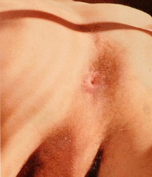 Rump! 5b37cf12b58b2.jpg