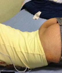 Bubble Butts 1 574e93fe2ea19.jpg