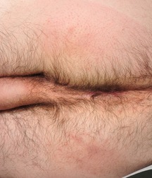 19n_Louis 5ca0b35f61fec.jpg