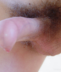 MIKA CUTE FORESKIN 5730e60e4f03f.jpg