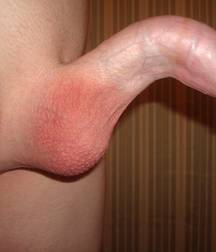 Penises 58dd9ccfb7c67.jpg