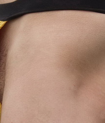 Bulges ..... 582f380fd54dd.jpg