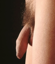 PENIS MIX 5878b05f430db.jpg