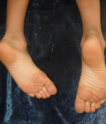 Boys's feet 59 58c565eaa66a4.jpg