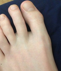 Boys's feet 70 59a3e58617290.jpg