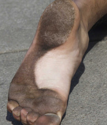 Boys's feet 79 59eca4eb51573.jpg