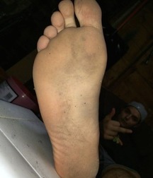 Boys's feet 80 59eca67fd6512.jpg