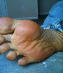 Boys's feet 82 5a0194a33bb2f.jpg