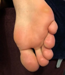 Boys's feet 83 5a0ae3e03a5d7.jpg