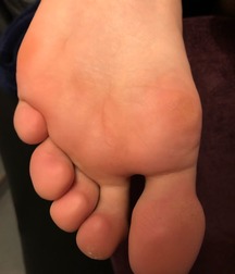 Boys's feet 83 5a0ae3e6f0af4.jpg