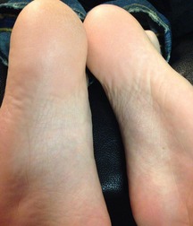 Boys's feet 88 5a148639973c9.jpg