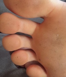 Boys's feet 92 5a198b9f088bc.jpg