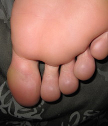 Boys's feet 94 5a38e7213e3eb.jpg