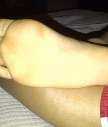 Boys's feet 94 5a38e792d4598.jpg