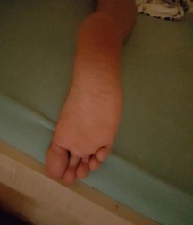 Boys's feet 100 5a5f2df30a638.jpg