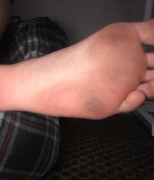 Boys's feet 103 5a7f3c086d7e8.jpg